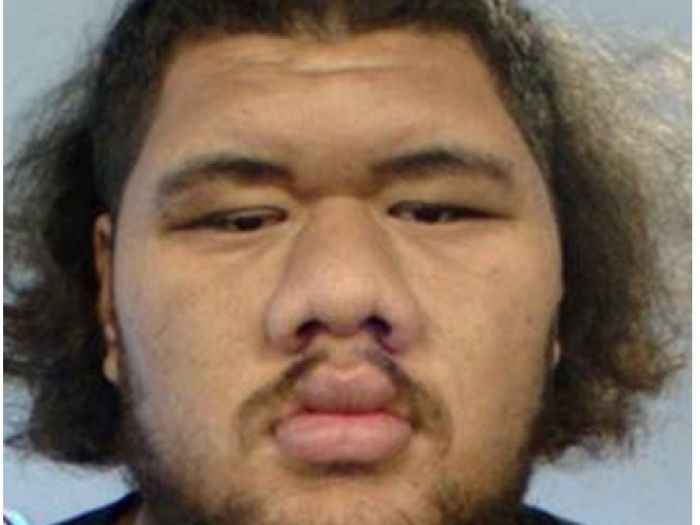 A close up photo of the head of Siafolau Siafolau